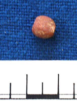 Bead